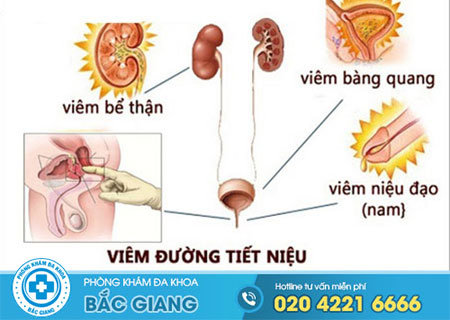 tim-hieu-ve-benh-viem-duong-tiet-nieu-o-nam-gioi