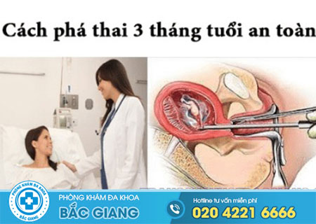 chi-phi-pha-thai-3-thang-tuoi