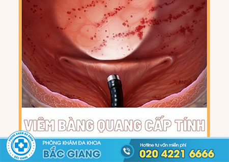 viem-bang-quang-co-nguy-hiem-khong